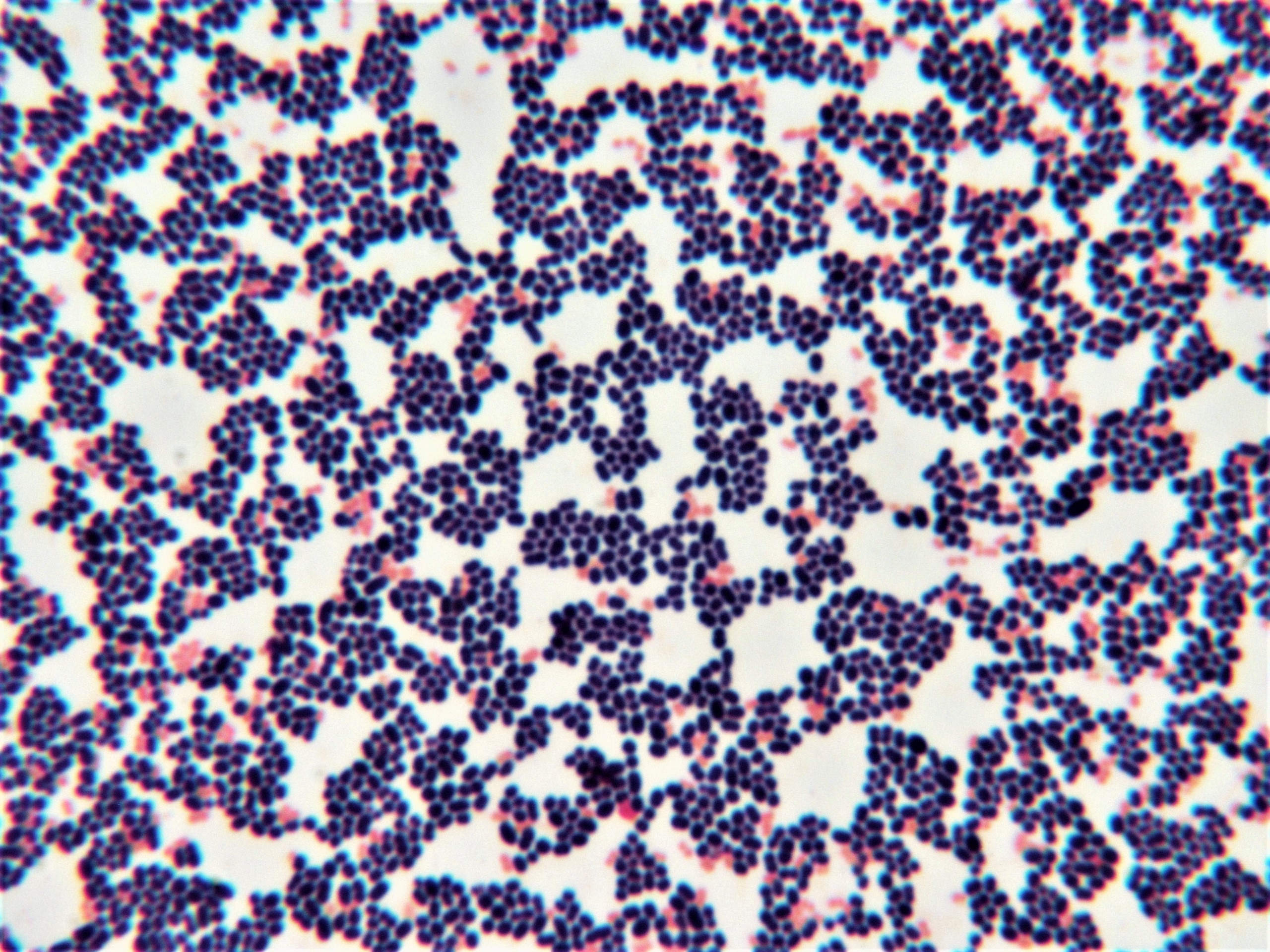 kräftig violettblau gefärbte kugelförmige Strukturen